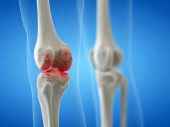 Best Orthopedic and Spine Surgeon in Dhaka Bangladesh